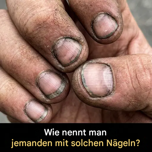 Wie nennt man jemanden mit solchen Nägeln?