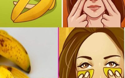 Bananenschalen nicht wegwerfen. Hier sind 7 wichtige