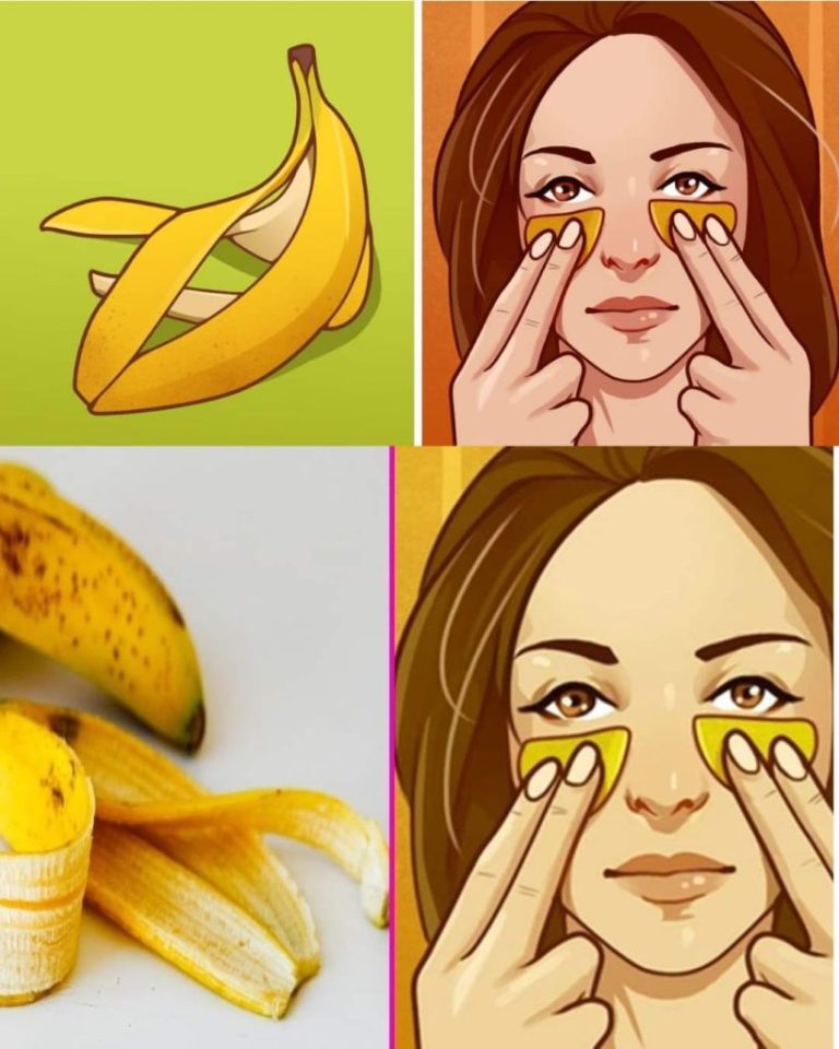 Bananenschalen nicht wegwerfen. Hier sind 7 wichtige