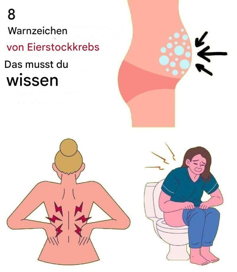 8 Warnsignale für Eierstockkrebs, die Sie nicht ignorieren sollten