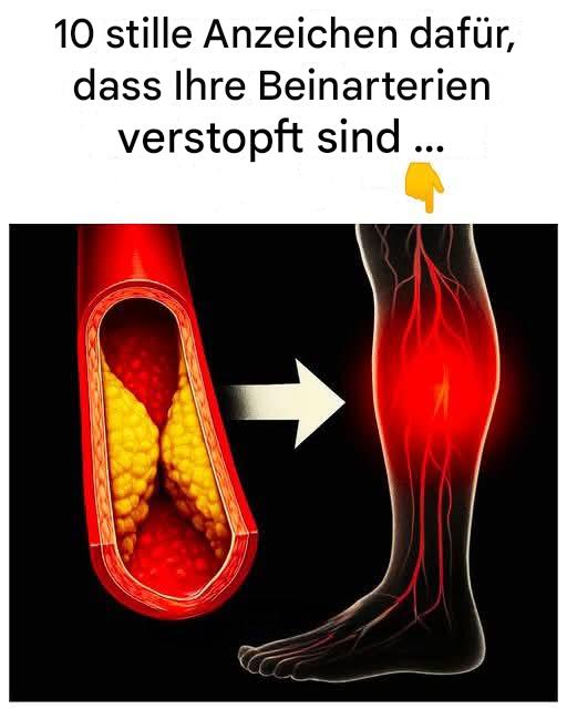 50 % der Menschen mit dieser Krankheit wissen nicht einmal, dass sie sie haben