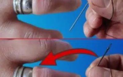 So entfernen Sie einen festsitzenden Ring einfach mit einer Nadel von Ihrem Finger