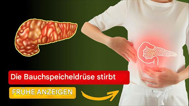 Die Bauchspeicheldrüse stirbt! 12 seltsame Anzeichen für Bauchspeicheldrüsenkrebs (Link in den Kommentaren)