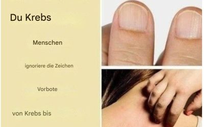 15 Warnsignale für Krebs, die Menschen ignorieren, bis es zu spät ist