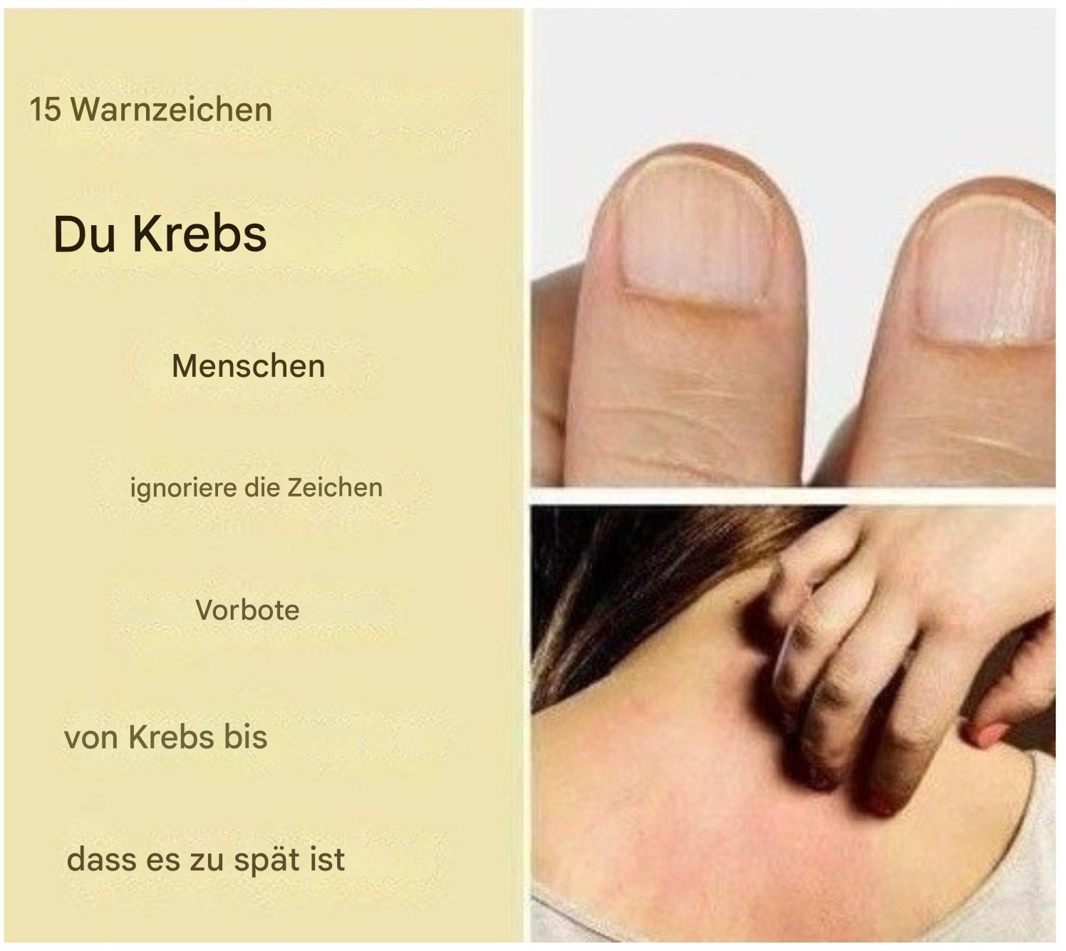 15 Warnsignale für Krebs, die Menschen ignorieren, bis es zu spät ist
