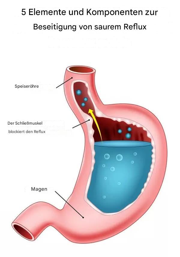 5 Vitamine zur natürlichen Bekämpfung von saurem Reflux