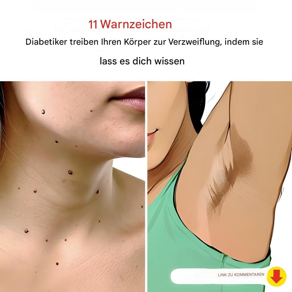 11 wirklich seltsame Symptome von Diabetes