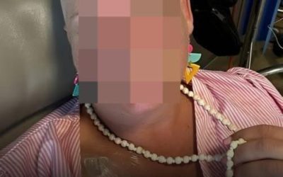 Eine 47-jährige Frau mit Krebs im Endstadium warnt vor subtilen Symptomen, die ihr möglicherweise entgangen sind.