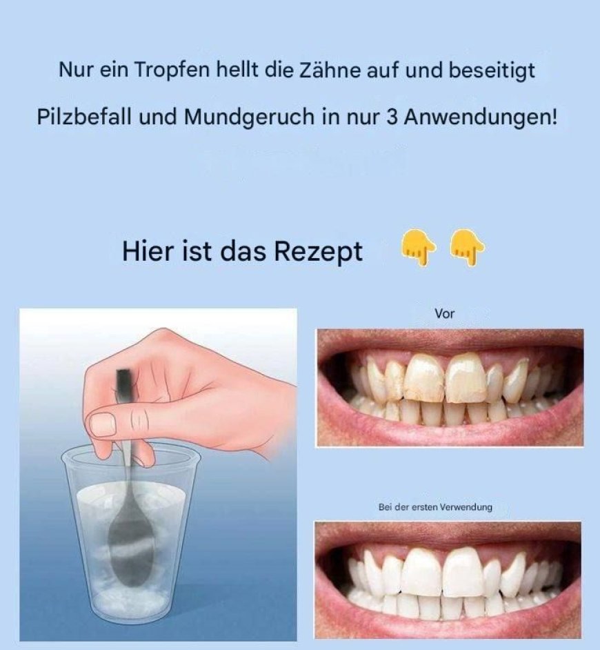 Entfernen Sie Zahnstein und bleichen Sie Ihre Zähne mit diesem einfachen Rezept.