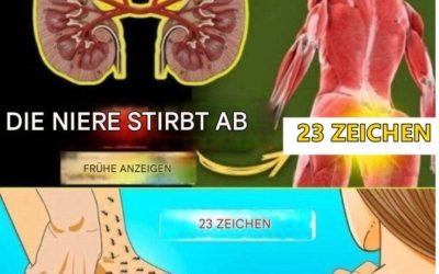 23 ungewöhnliche Symptome einer Nierenerkrankung, die leicht übersehen werden – überprüfen Sie, bevor es zu spät ist