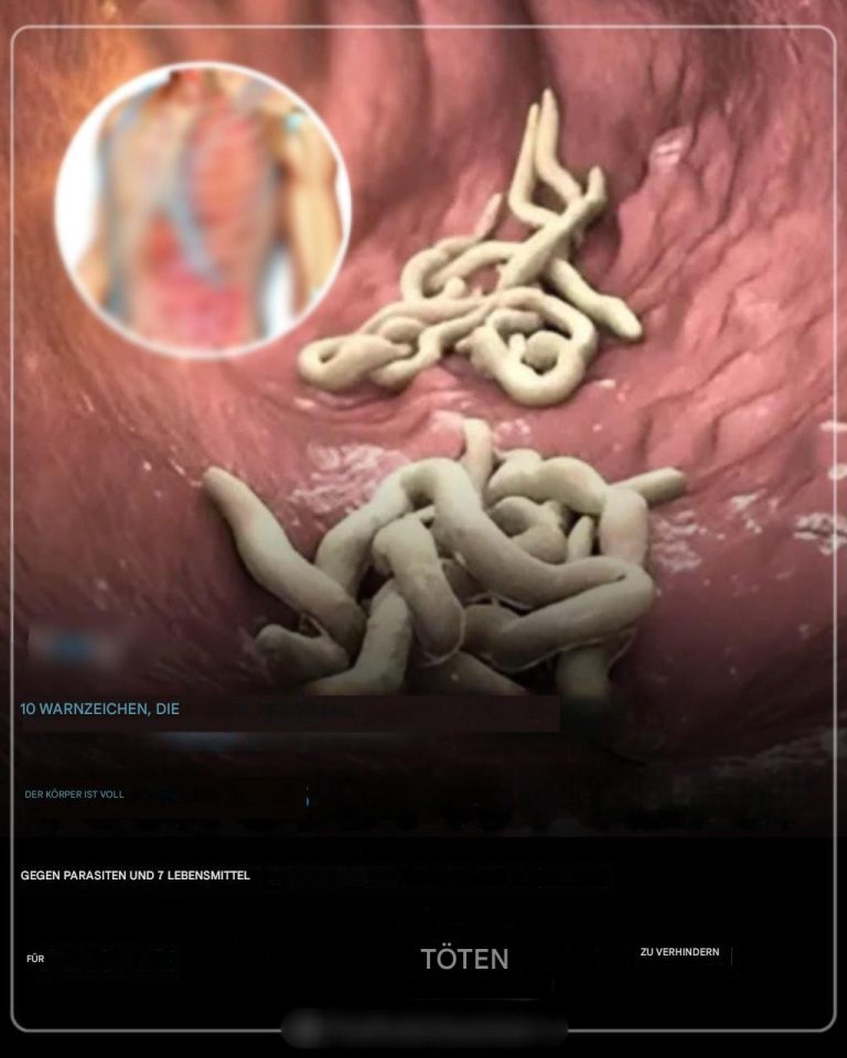 Ihr Körper ist voller Parasiten