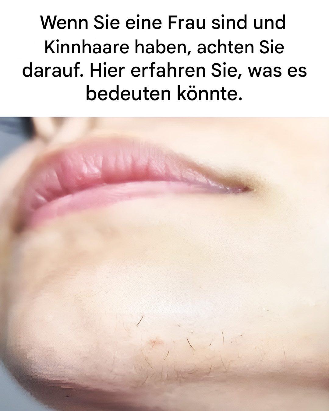 Kinnhaare bei Frauen: Was bedeutet das?