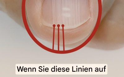 Wenn nach 40 Jahren Falten auf Ihren Nägeln erscheinen, könnte dies ein Warnzeichen sein…