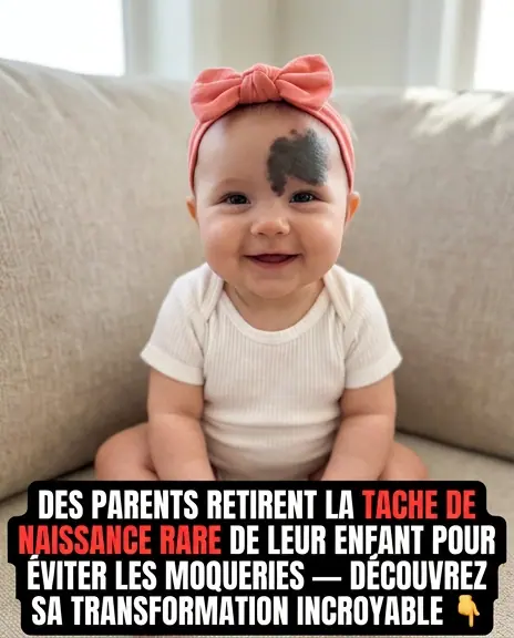 Grausame Reaktionen zwingen Eltern dazu, ein seltenes Muttermal von ihrem Baby entfernen zu lassen