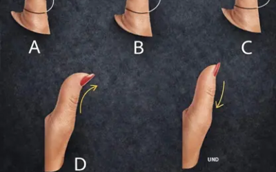 Der Fingerabdruck des Schicksals: Was Ihr stärkster Finger über Ihre Gesundheit und Ihre Zukunft verrät