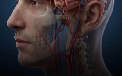 Aneurysma: Anzeichen, die Sie nicht ignorieren sollten…