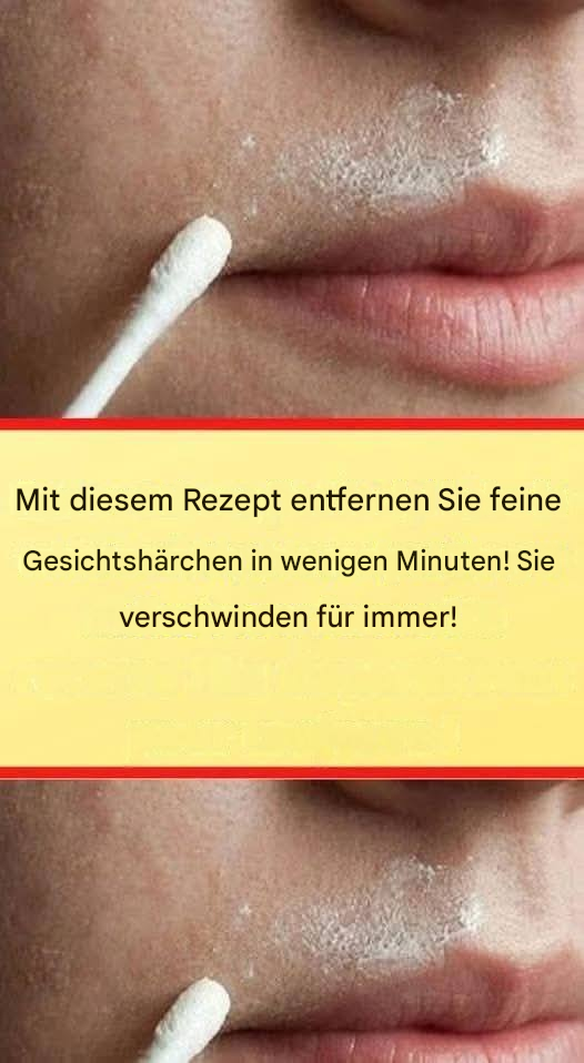 Dieses natürliche Rezept entfernt Gesichtshaare dauerhaft.