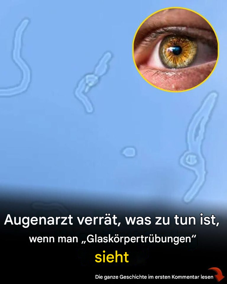 Was sind Glaskörpertrübungen? Was Sie laut einem Augenarzt tun sollten, wenn Sie sie bemerken.