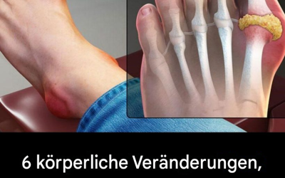 Ihr Körper kann diese 6 Anzeichen zeigen, wenn Ihre Herzgesundheit gefährdet ist.