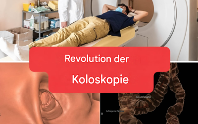 Neue Methode: Die Darmspiegelung wird keine invasive Untersuchung mehr sein. (1/2)