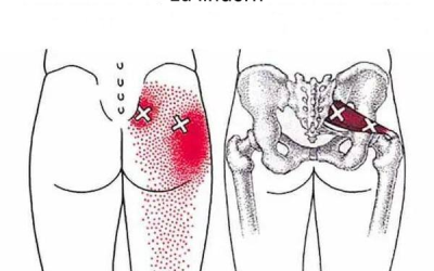 Piriformis-Dehnübungen zur Linderung des Piriformis-Syndroms