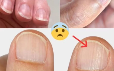 Der Arzt enthüllt 7 Gesundheitsprobleme, die sich in Ihren Nägeln verbergen.