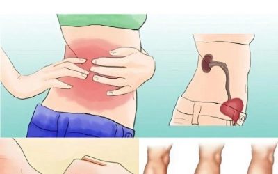 10 Symptome einer Nierenerkrankung