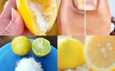 Nagelpilzentfernung: 100 % natürliche Nagelpilzbehandlung