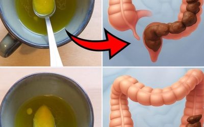 Mittel zur Reinigung des Dickdarms