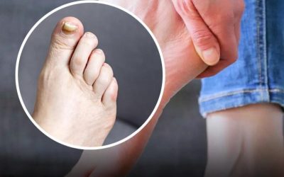 Ein Apotheker enthüllt zwei Warnzeichen für einen stillen Mörder, die Sie an Ihren Füßen erkennen könnten