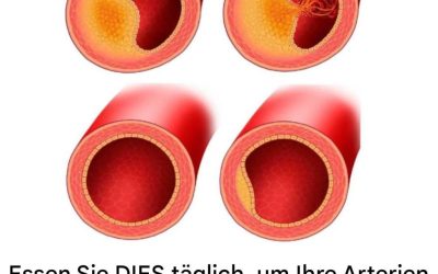 Die besten Lebensmittel zur Reinigung und Vorbeugung verstopfter Arterien