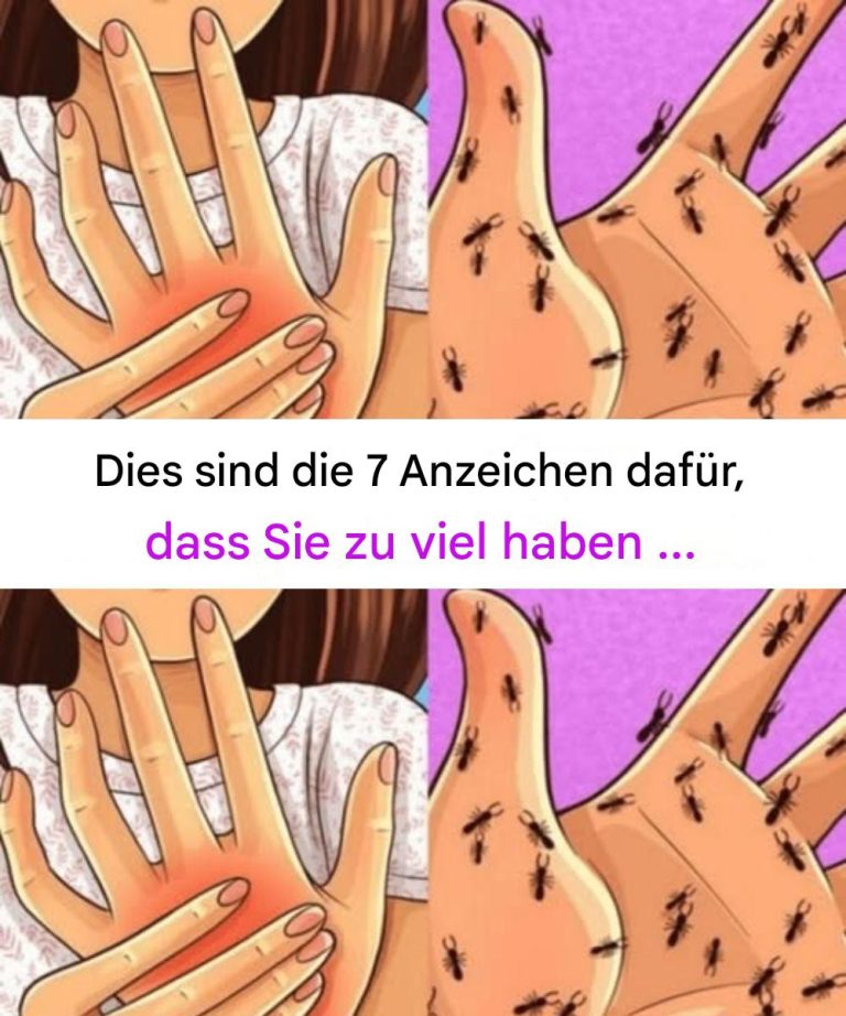 Dies sind die 7 Anzeichen dafür, dass Sie zu viel haben …