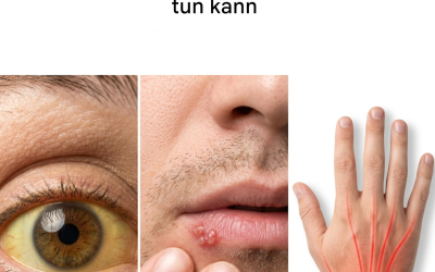 8 Anzeichen für Vitamin-B12-Mangel und was Sie dagegen tun können