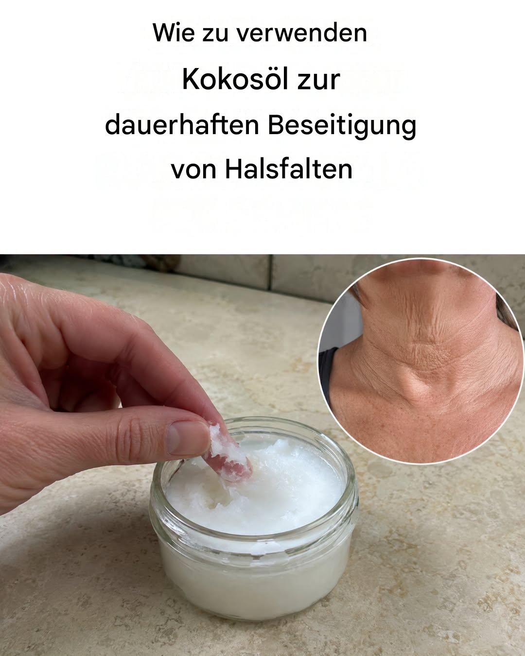 Wie man mit Kokosöl Halsfalten reduziert