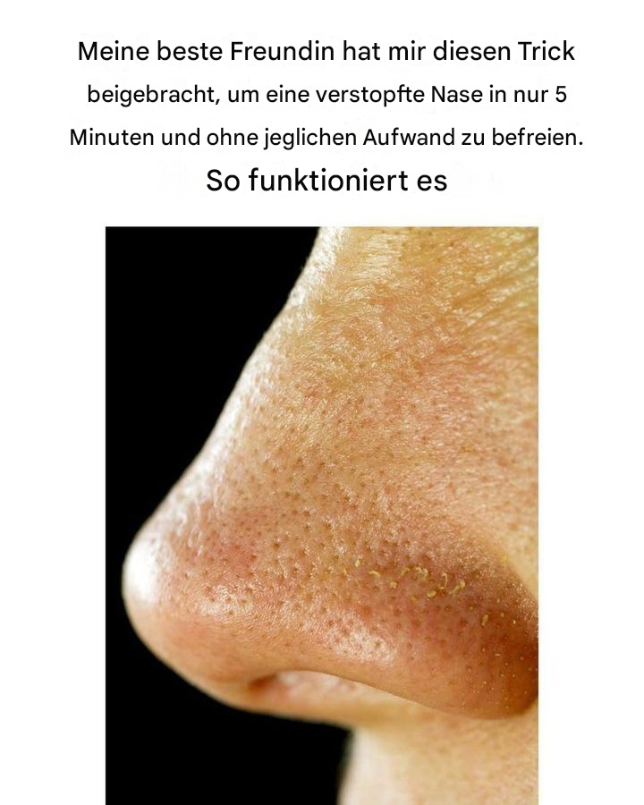 Meine beste Freundin hat mir diesen Trick beigebracht, um eine verstopfte Nase in nur 5 Minuten zu befreien.