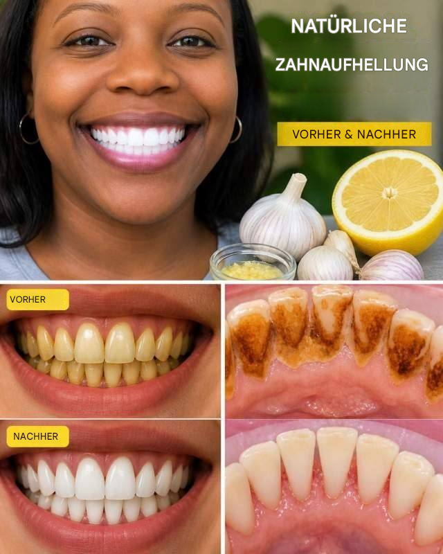 Was Zitrone bei gelben Zähnen bewirkt, wenn Zähneputzen nicht mehr hilft