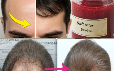 Ich bin total begeistert! Dank dieser Zutat wachsen die Haare an meiner kahlen Stelle wie verrückt! Ich muss einfach etwas dazu sagen, damit ich weiterhin meine Rezepte bekomme…