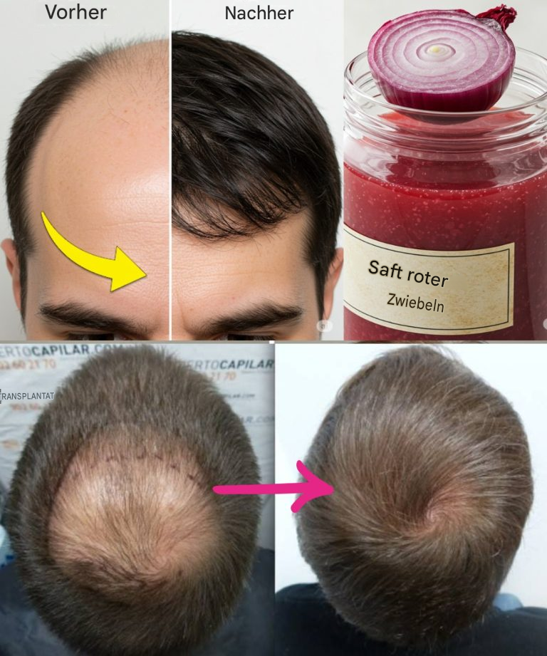 Ich bin total begeistert! Dank dieser Zutat wachsen die Haare an meiner kahlen Stelle wie verrückt! Ich muss einfach etwas dazu sagen, damit ich weiterhin meine Rezepte bekomme…