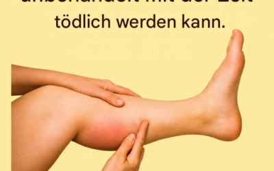Die 6 besten Kräutertees für gesunde Arterien auf natürliche Weise