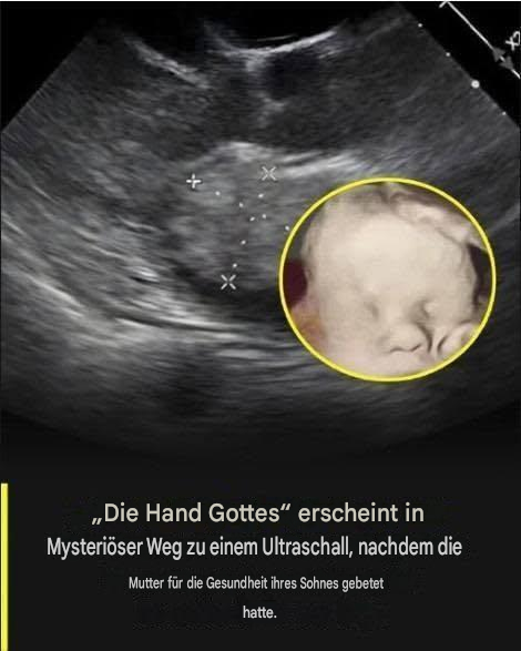 Diese schwangere Frau wünschte sich ein Fotoshooting mit Hunderten von Bienen auf ihrem Bauch.