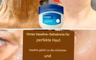 Omas Geheimnis für perfekte Haut mit Vaseline