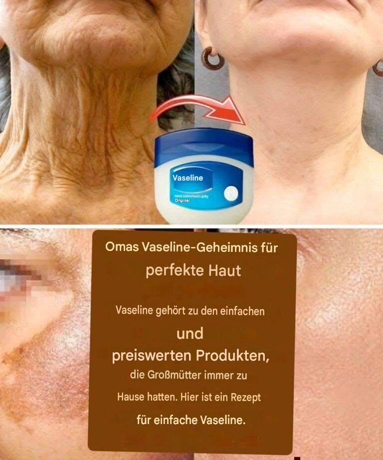 Omas Geheimnis für perfekte Haut mit Vaseline