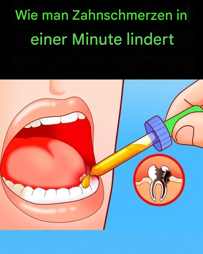 10 Wege, Zahnschmerzen in einer Minute loszuwerden