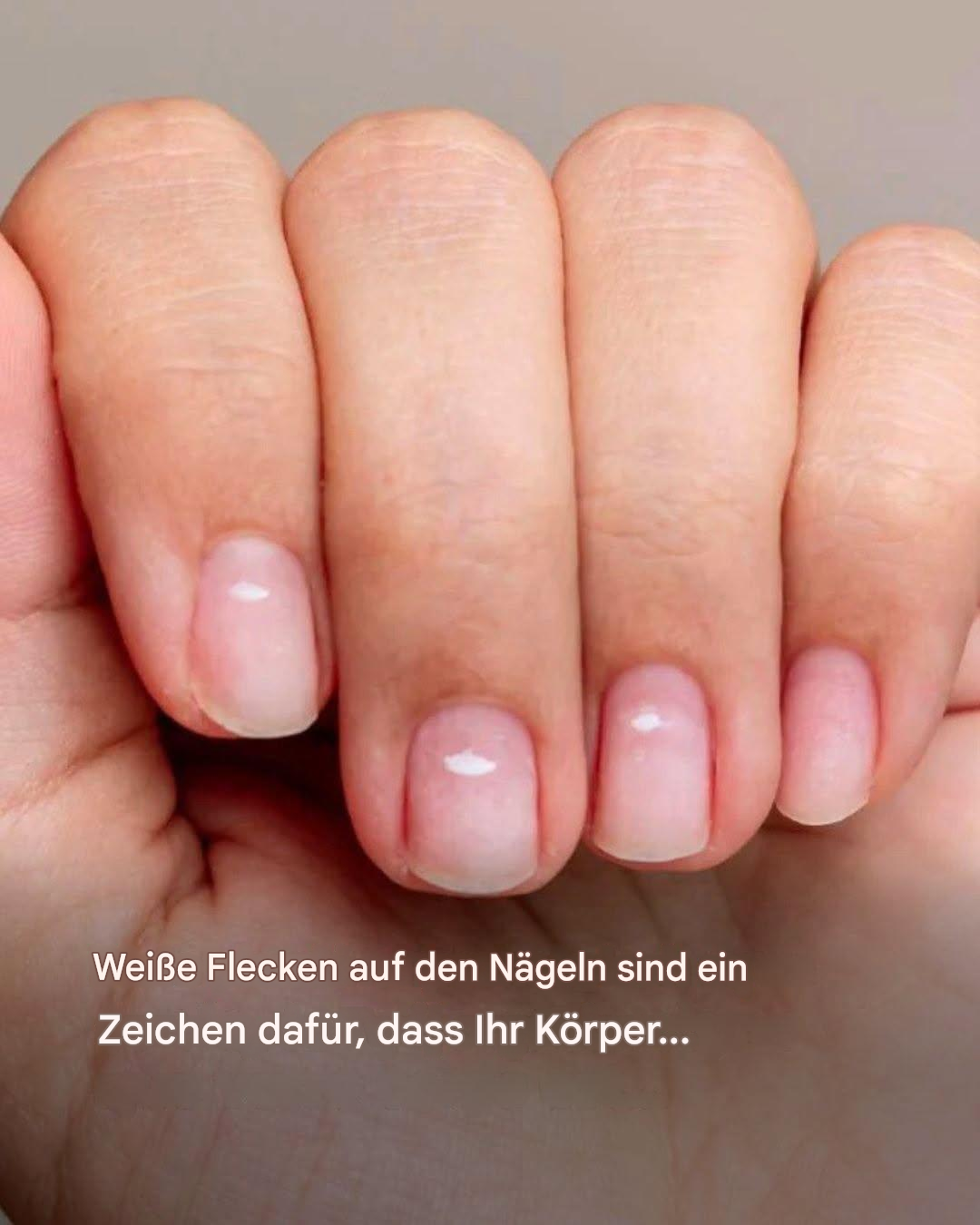 Weiße Flecken auf den Nägeln sind ein Zeichen dafür, dass Ihr Körper… Mehr anzeigen