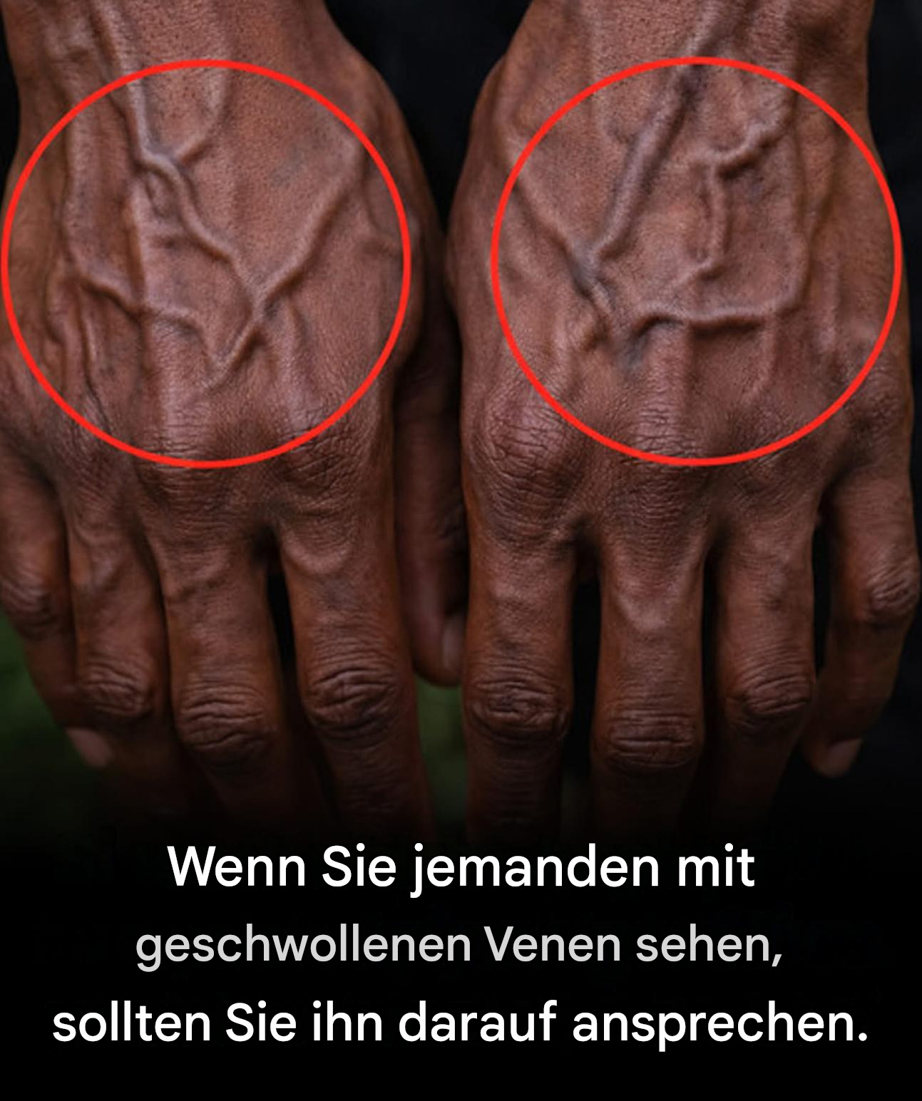 Wenn Ihre Venen sichtbar sind, bedeutet das… Mehr dazu 👇