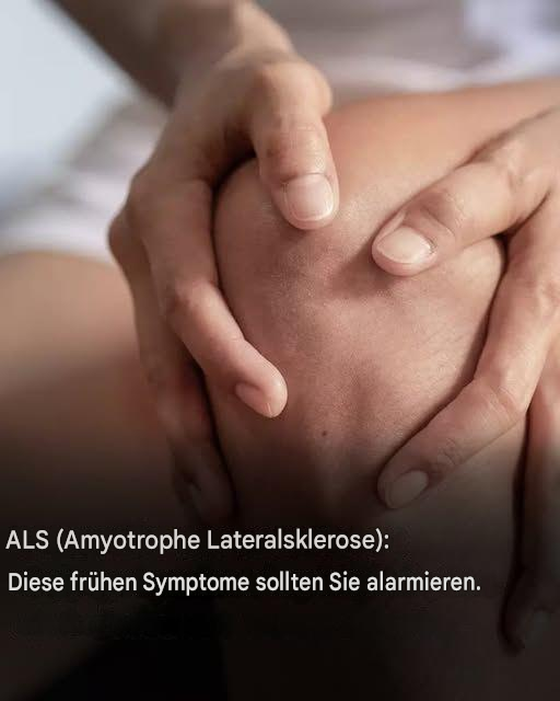 ALS (Amyotrophe Lateralsklerose): Dies sind die ersten Symptome dieser Krankheit.
