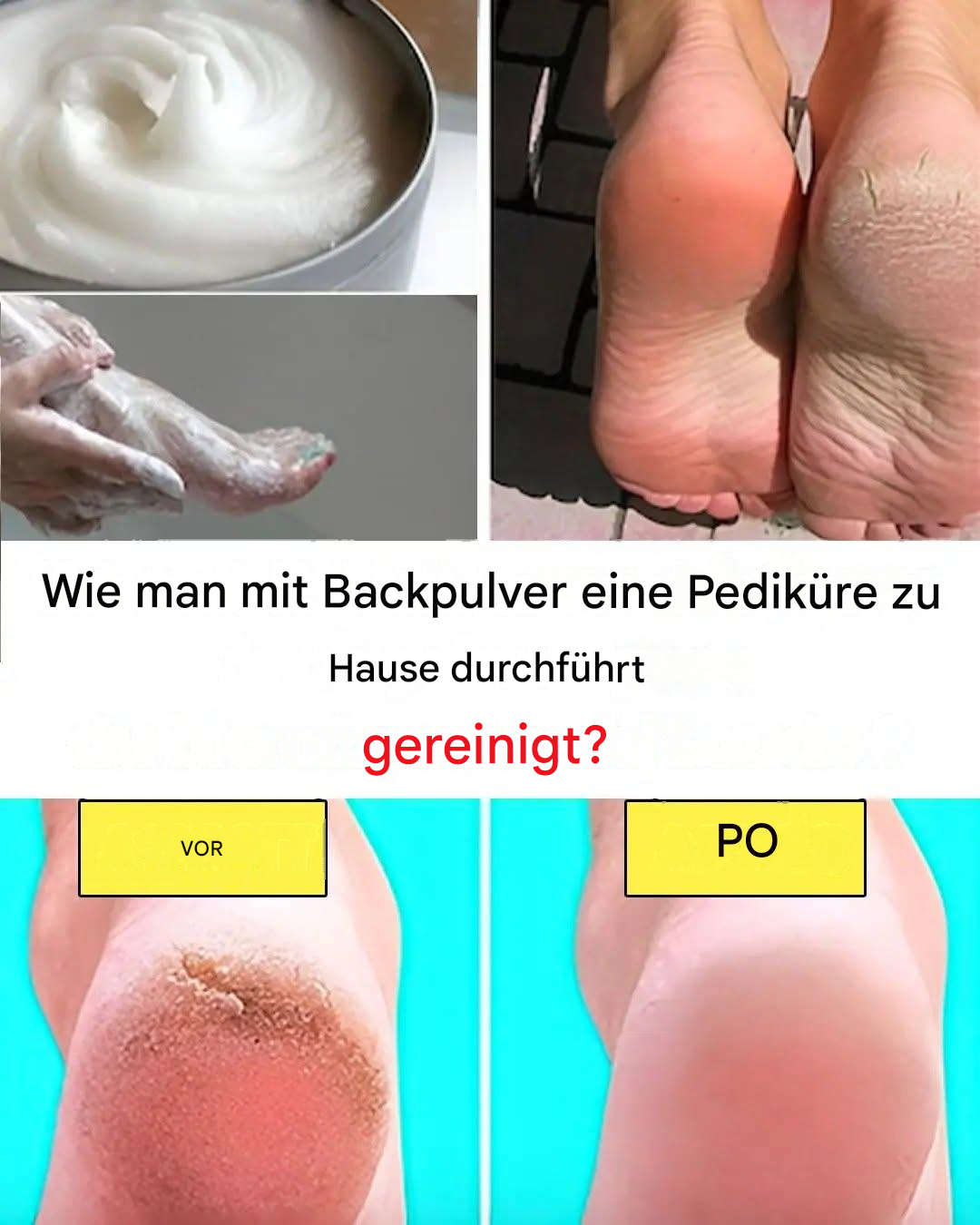 Gönnen Sie sich eine Pediküre wie im Spa – mit einem Küchenprodukt: Natron.