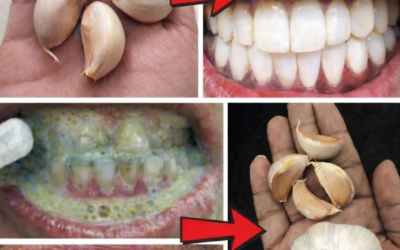 Nutzen Sie die natürliche Kraft des Knoblauchs für ein gesünderes Lächeln.