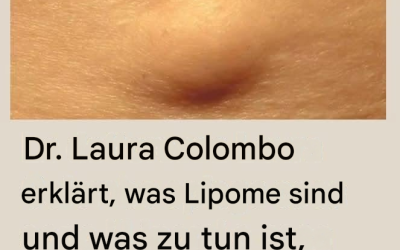 Dr. Laura Colombo erklärt, was Lipome sind und was zu tun ist, wenn man eines hat (1/2).