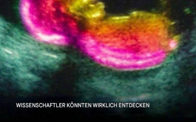 Wissenschaftler haben möglicherweise eine der Ursachen von Autismus identifiziert.